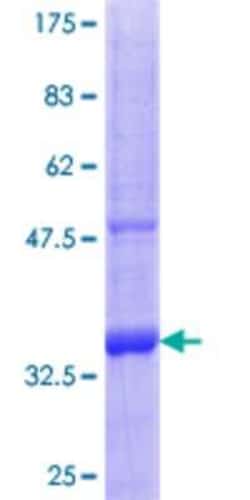 Novus Biologicals Recombinant Human SLC22A9 GST (N-Term) Protein 10 &mu;g | Buy Online | Novus Biologicals&trade; | Fisher Scientific