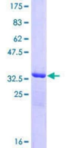 Novus Biologicals Recombinant Human COP GST (N-Term) Protein 25 &mu;g | Buy Online | Novus Biologicals&trade; | Fisher Scientific