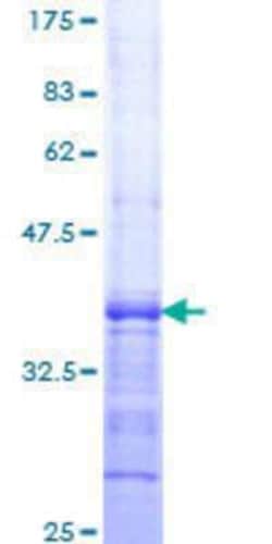 Novus Biologicals Recombinant Human COP GST (N-Term) Protein 25 &mu;g | Buy Online | Novus Biologicals&trade; | Fisher Scientific