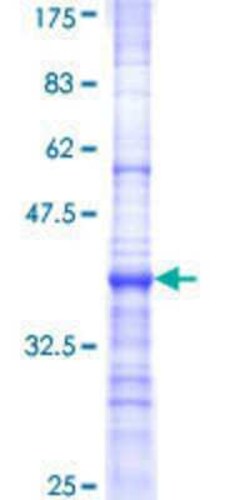 Novus Biologicals Recombinant Human BTBD9 GST (N-Term) Protein 10 &mu;g | Buy Online | Novus Biologicals&trade; | Fisher Scientific