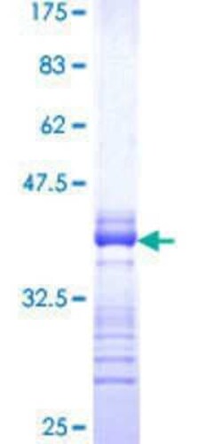 Novus Biologicals Recombinant Human LMTK3 GST (N-Term) Protein 2 &mu;g | Buy Online | Novus Biologicals&trade; | Fisher Scientific