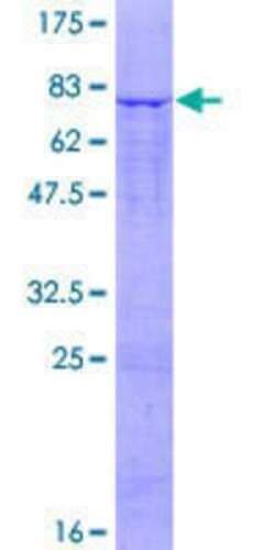 Novus Biologicals Recombinant Human SLC25A25 GST (N-Term) Protein 10 &mu;g | Buy Online | Novus Biologicals&trade; | Fisher Scientific