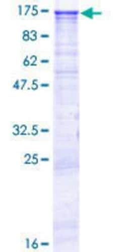 Novus Biologicals Recombinant Human TUBGCP5 GST (N-Term) Protein 10 &mu;g | Buy Online | Novus Biologicals&trade; | Fisher Scientific