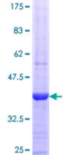 Novus Biologicals Recombinant Human TUBGCP5 GST (N-Term) Protein 25 &mu;g | Buy Online | Novus Biologicals&trade; | Fisher Scientific