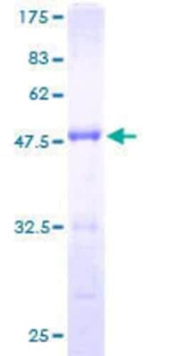 Novus Biologicals Recombinant Human FMNL2 GST (N-Term) Protein 25 &mu;g | Buy Online | Novus Biologicals&trade; | Fisher Scientific
