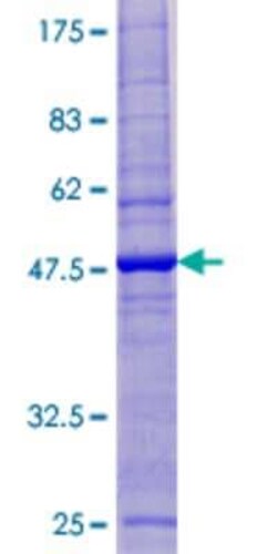 Novus Biologicals Recombinant Human Eco1 GST (N-Term) Protein 25 &mu;g | Buy Online | Novus Biologicals&trade; | Fisher Scientific