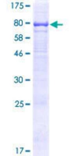 Novus Biologicals Recombinant Human TMEM200A GST (N-Term) Protein 10 &mu;g | Buy Online | Novus Biologicals&trade; | Fisher Scientific