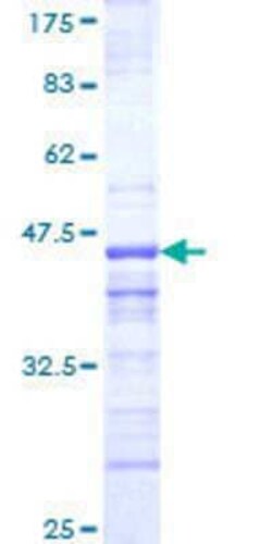 Novus Biologicals Recombinant Human RNF157 GST (N-Term) Protein 10 &mu;g | Buy Online | Novus Biologicals&trade; | Fisher Scientific