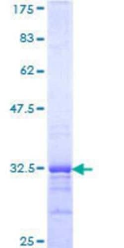 Novus Biologicals Recombinant Human GNRHR2 GST (N-Term) Protein 10 &mu;g | Buy Online | Novus Biologicals&trade; | Fisher Scientific