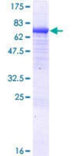 Novus Biologicals Recombinant Human KLHL29 GST (N-Term) Protein 10 &mu;g | Buy Online | Novus Biologicals&trade; | Fisher Scientific