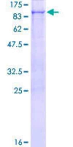 Novus Biologicals Recombinant Human RHPN1 GST (N-Term) Protein 10 &mu;g | Buy Online | Novus Biologicals&trade; | Fisher Scientific