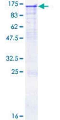 Novus Biologicals Recombinant Human ORP8 GST (N-Term) Protein 10 &mu;g | Buy Online | Novus Biologicals&trade; | Fisher Scientific