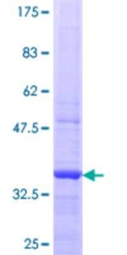 Novus Biologicals Recombinant Human ORP8 GST (N-Term) Protein 25 &mu;g | Buy Online | Novus Biologicals&trade; | Fisher Scientific