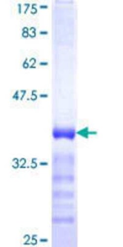 Novus Biologicals Recombinant Human MARCH3 GST (N-Term) Protein 25 &mu;g | Buy Online | Novus Biologicals&trade; | Fisher Scientific