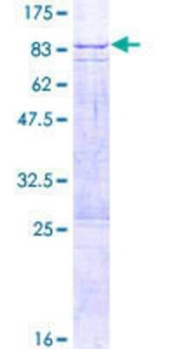 Novus Biologicals Recombinant Human OMA1 GST (N-Term) Protein 2 &mu;g | Buy Online | Novus Biologicals&trade; | Fisher Scientific