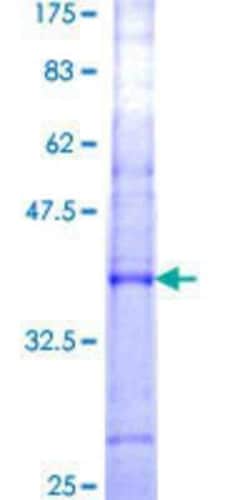 Novus Biologicals Recombinant Human FBG4 GST (N-Term) Protein 25 &mu;g | Buy Online | Novus Biologicals&trade; | Fisher Scientific