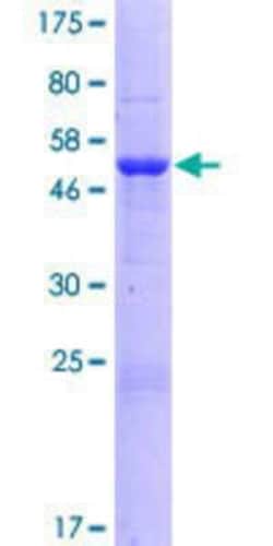 Novus Biologicals&trade;&nbsp;Recombinant Human MALSU1 GST (N-Term) Protein