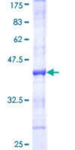 Novus Biologicals Recombinant Human NIRF GST (N-Term) Protein 10 &mu;g | Buy Online | Novus Biologicals&trade; | Fisher Scientific