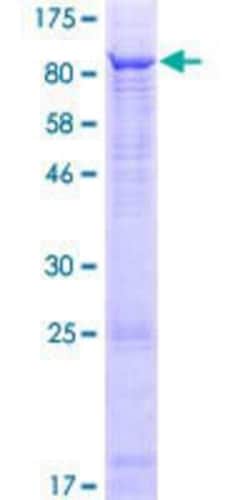 Novus Biologicals&trade;&nbsp;Recombinant Human TTC6 GST (N-Term) Protein