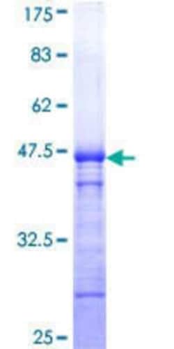 Novus Biologicals Recombinant Human ALPK2 GST (N-Term) Protein 10 &mu;g | Buy Online | Novus Biologicals&trade; | Fisher Scientific
