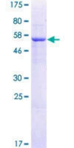 Novus Biologicals Recombinant Human TRMT61A GST (N-Term) Protein 10 &mu;g | Buy Online | Novus Biologicals&trade; | Fisher Scientific