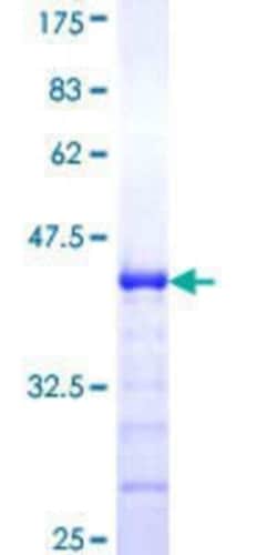 Novus Biologicals Recombinant Human RASGRP 4 GST (N-Term) Protein 10 &mu;g | Buy Online | Novus Biologicals&trade; | Fisher Scientific
