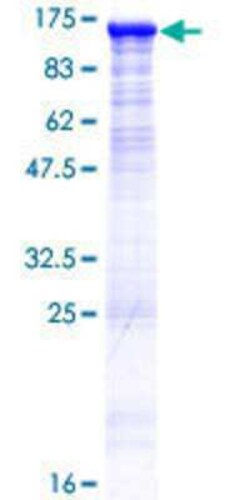 Novus Biologicals Recombinant Human DIS3L GST (N-Term) Protein 25 &mu;g | Buy Online | Novus Biologicals&trade; | Fisher Scientific