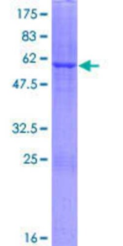 Novus Biologicals Recombinant Human DHRS1 GST (N-Term) Protein 25 &mu;g | Buy Online | Novus Biologicals&trade; | Fisher Scientific