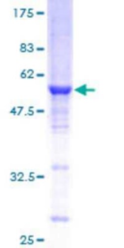 Novus Biologicals Recombinant Human Rab3C GST (N-Term) Protein 10 &mu;g | Buy Online | Novus Biologicals&trade; | Fisher Scientific