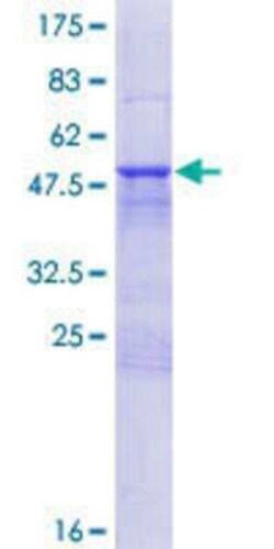 Novus Biologicals Recombinant Human TXNL6 GST (N-Term) Protein 10 &mu;g | Buy Online | Novus Biologicals&trade; | Fisher Scientific
