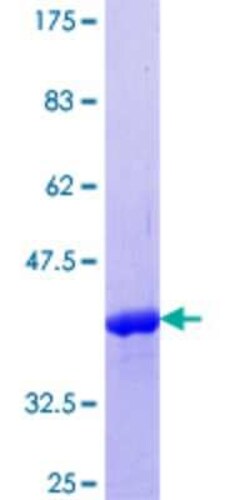 Novus Biologicals Recombinant Human RNF166 GST (N-Term) Protein 25 &mu;g | Buy Online | Novus Biologicals&trade; | Fisher Scientific