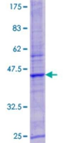Novus Biologicals Recombinant Human LYSMD3 GST (N-Term) Protein 25 &mu;g | Buy Online | Novus Biologicals&trade; | Fisher Scientific