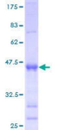 Novus Biologicals Recombinant Human MGC20410 GST (N-Term) Protein 25 &mu;g | Buy Online | Novus Biologicals&trade; | Fisher Scientific