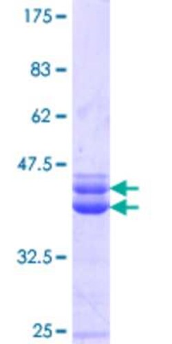 Novus Biologicals Recombinant Human FoxP4 GST (N-Term) Protein 10 &mu;g | Buy Online | Novus Biologicals&trade; | Fisher Scientific