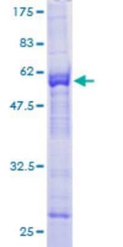 Novus Biologicals&trade;&nbsp;Recombinant Human KLHDC3 GST (N-Term) Protein
