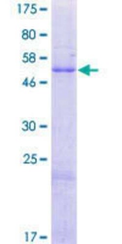 Novus Biologicals Recombinant Human Nogo B receptor GST (N-Term) Protein 2 &mu;g | Buy Online | Novus Biologicals&trade; | Fisher Scientific