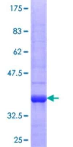 Novus Biologicals Recombinant Human PHACTR3 GST (N-Term) Protein 25 &mu;g | Buy Online | Novus Biologicals&trade; | Fisher Scientific