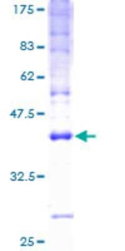 Novus Biologicals Recombinant Human CMTM5 GST (N-Term) Protein 25 &mu;g | Buy Online | Novus Biologicals&trade; | Fisher Scientific