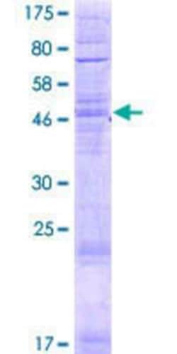 Novus Biologicals Recombinant Human TLCD1 GST (N-Term) Protein 2 &mu;g | Buy Online | Novus Biologicals&trade; | Fisher Scientific
