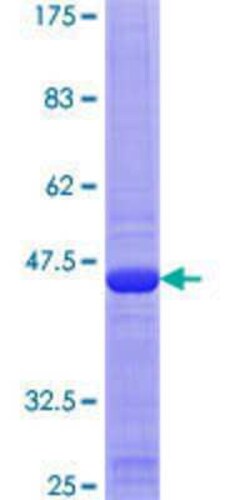Novus Biologicals Recombinant Human MRPL54 GST (N-Term) Protein 10 &mu;g | Buy Online | Novus Biologicals&trade; | Fisher Scientific
