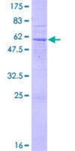 Novus Biologicals Recombinant Human ART5 GST (N-Term) Protein 10 &mu;g | Buy Online | Novus Biologicals&trade; | Fisher Scientific