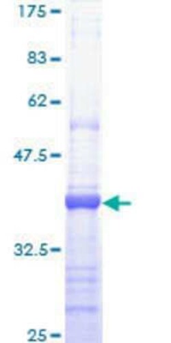 Novus Biologicals Recombinant Human ARAP1 GST (N-Term) Protein 25 &mu;g | Buy Online | Novus Biologicals&trade; | Fisher Scientific