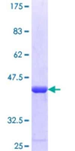 Novus Biologicals Recombinant Human CATSPER1 GST (N-Term) Protein 10 &mu;g | Buy Online | Novus Biologicals&trade; | Fisher Scientific