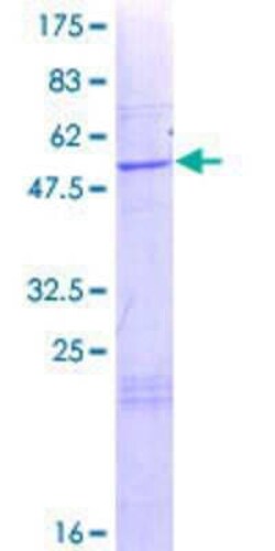Novus Biologicals Recombinant Human THEM4 GST (N-Term) Protein 25 &mu;g | Buy Online | Novus Biologicals&trade; | Fisher Scientific