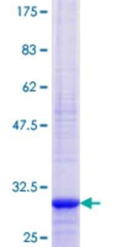 Novus Biologicals Recombinant Human THEM4 GST (N-Term) Protein 25 &mu;g | Buy Online | Novus Biologicals&trade; | Fisher Scientific