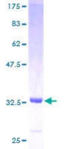 Novus Biologicals Recombinant Human UGRP1/SCGB3A2 GST (N-Term) Protein 25 &mu;g | Buy Online | Novus Biologicals&trade; | Fisher Scientific
