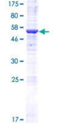 Novus Biologicals Recombinant Human HRASLS5 GST (N-Term) Protein 10 &mu;g | Buy Online | Novus Biologicals&trade; | Fisher Scientific
