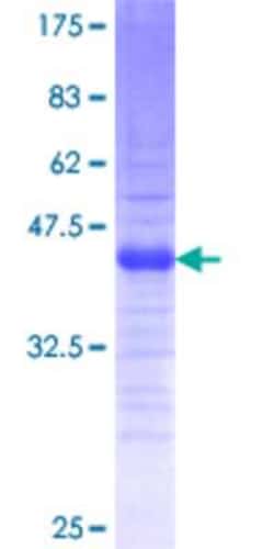Novus Biologicals Recombinant Human Twist-2 GST (N-Term) Protein 10 &mu;g | Buy Online | Novus Biologicals&trade; | Fisher Scientific