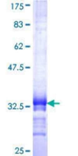 Novus Biologicals Recombinant Human Exosome component 6 GST (N-Term) Protein 25 &mu;g | Buy Online | Novus Biologicals&trade; | Fisher Scientific