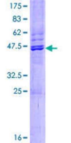Novus Biologicals Recombinant Human PRAP1 GST (N-Term) Protein 10 &mu;g | Buy Online | Novus Biologicals&trade; | Fisher Scientific